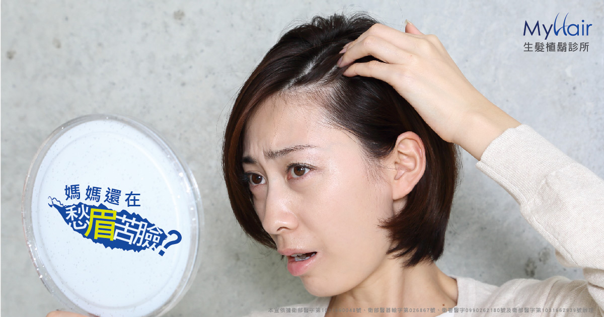 Female Hairline 20200513a 1