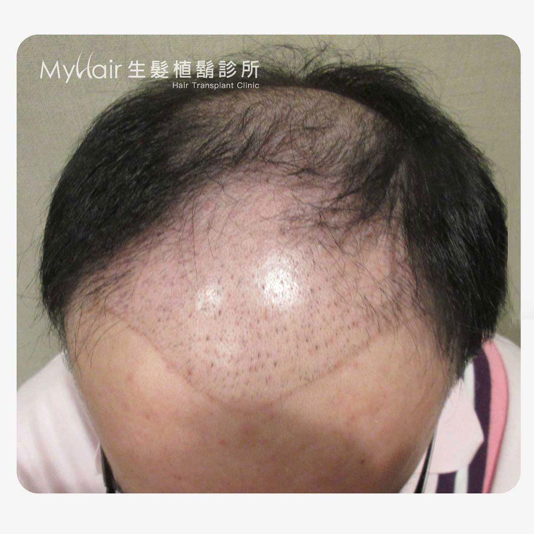 Hairprice 03