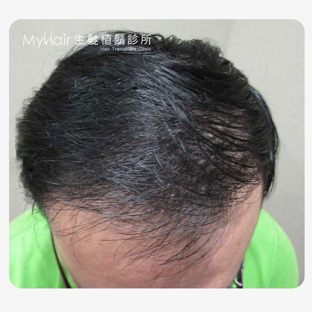 Hairprice 04